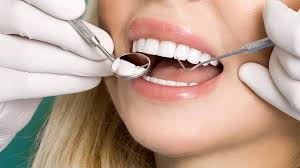 Porselen diş uygulamaları arasında kuşkusuz en meşakkatli olan uygulama full porselen diş kaplama uygulamalarıdır. Dis Kaplamasi Nasil Yapilir Kaplama Dise Zarar Verir Mi Guzellik Haberleri