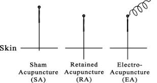 Hasil gambar untuk acupuncture electronic block diagram
