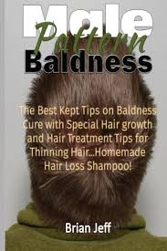 The good news is rogaine or minoxidil has shown to reduce the loss of hair in men. Male Pattern Baldness The Best Kept Tips On Baldness Cure With Special Hair Growth And Hair Treatment Tips For Thinning Hair Homemade Hair Loss Shampoo Jeff Brian 9781530440641 Amazon Com Books