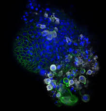 Intestinal organoid infected with coronavirus SARS-CoV-2 [image] |  EurekAlert! Science News