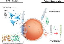 Maybe you would like to learn more about one of these? Potential Therapeutic Usage Of Nanomedicine For Glaucoma Treatment Ijn