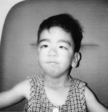 Ocular Findings in Jacobsen Syndrome