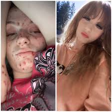 Recovery photoshoot in Gainesville, GA