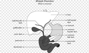 Bile duct common bile duct laparoscopic cholecystectomy biliary tract primary sclerosing cholangitis. Biliary Tract Png Images Pngwing