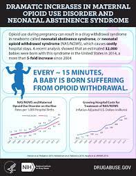 Dramatic Increases In Maternal Opioid Use And Neonatal Abstinence Syndrome Nida Archives