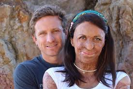 I make cool stuff that helps people get happier:. Marieclaireau On Twitter Congratulations Turia Pitt And Michael Hoskin Have Welcomed Their First Baby Https T Co 8e90yyhzab