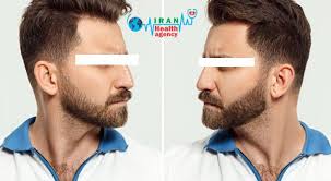 ماذا تعرف عن التعلیمالت بعد تجميل الأنف In 2020