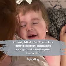 September 8th is Lissencephaly Awareness Day 💜 I'm not sure I'll ever be  able to express what an honor it is to share Marsaili's story. To have  loved such a marvelous miracle.