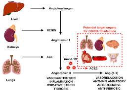 Myocarditis, also known as inflammatory cardiomyopathy, is inflammation of the heart muscle. Covid 19 As A Possible Cause Of Myocarditis And Pericarditis American College Of Cardiology