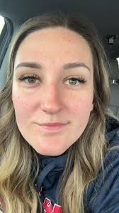 How can I even the texture and ease redness, I do get semi monthly facials 