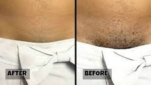 This level of growth typically takes 2 to 3 weeks from a previous wax, or about 2 weeks from the last time you. Stop Shaving This Is How You Should Remove Pubic Hair Without Shaving Or Waxing Youtube