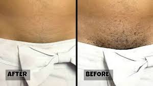 Fewer major styles of shaved pubic hair like lightning, diamond shape are becoming more popular. Stop Shaving This Is How You Should Remove Pubic Hair Without Shaving Or Waxing Youtube