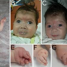 Angelika F. Hahn's research works