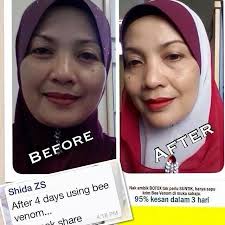 * diperbuat daripada bahan semulajadi. Cantikdenganbeevenom Ingin Kulit Yang Cantik Bebas Jerawat Bebas Kerutan Bebas Jeragat Awet Muda Glowing Serta Radiant Flawless Natural Beauty