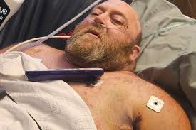 Fundraiser for Jimmy Slaight by Carly DePasquale : Support Jimmy's Long  Road to Recovery