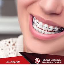 قسم تقويم الاسنان باشراف الدكتور معتصم مجمع عيادات الملز الطبى Malaz Medical Polyclinic Facebook