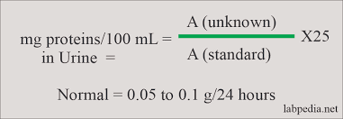 Diabetics are at a higher risk for developing urine ketones. Urine Complete Analysis Labpedia Net
