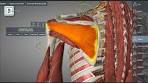 Uitstralende pijn in je schouder, arm of hand - YouTube