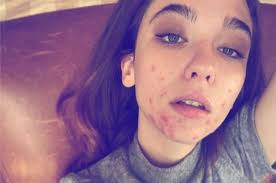 Matilda de angelis is the young bolognese actress who, day after day, year after year, is achieving truly spectacular success. Matilda De Angelis Opens Up About Her Acne On Instagram