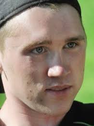 Skateboarding crash caused severe brain injury