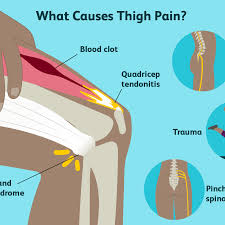 Weak tendons may be caused by tendonitis, use of steroids, older age, and chronic conditions such as arthritis. Thigh Pain Causes Treatment And When To See A Doctor