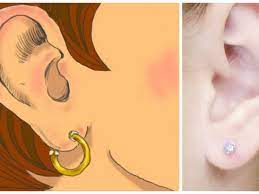What Is Ear Cheese And How Can We Get Rid Of It? | Littlethings.com