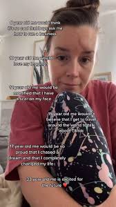 this was the first video I posted after my accident. I was absolutely  terified of what strangers