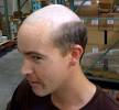 Hair Thinning Haircut