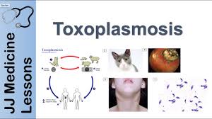 Toxoplasmosis Acquired Vs Congenital Signs Symptoms Diagnosis And Treatment Youtube