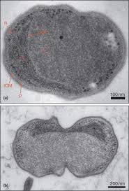 Maybe you would like to learn more about one of these? Planctomycetes An Overview Sciencedirect Topics