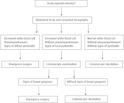 Image result for Sigmoid Volvulus