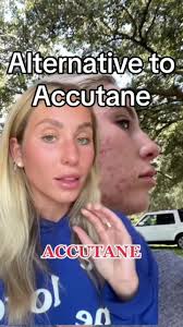 #stitch with @alix earle #greenscreen #accutane #acnetreatment #acne  #acneskin