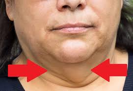 7 Faciles Consejos Para Perder Grasa Facial Y Afilar El Rostro Este tratamiento natural.perfilado de rostro. perder grasa facial y afilar el rostro