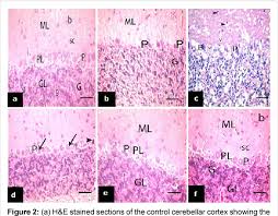 هناك بعض الآثار الجانبية التي من الممكن ان تحدث في حالة استخدام الدواء وهذه الآثار الجانبية هي : Figure 2 From Therapeutic Potential Of Mesenchymal Stem Cells Vs Estradiol Benzoate Or Avosoya On The Cerebellar Cortex Of Ovariectomized Adult Albino Rats Semantic Scholar