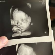 Julia Saunders and Will Mayer's Baby Registry at Babylist Julia Saunders  and Will Mayer's Baby Registry at Babylist