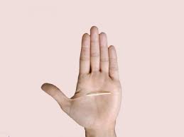 En estas últimas, hay 7 pastillas que solo contienen placebo. Nexplanon Implant Efectos Secundarios Del Implante Hormonal En El Brazo