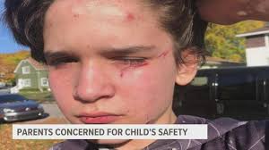 Grand Rapids family suing Navy Pier after climbing wall fall