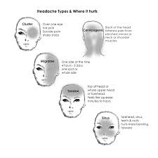 Wordpress Com Headache Types Headache Migraine Relief