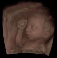 The Source articles for Chris Harris