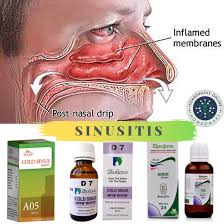 Post Nasal Drip Remedy In Homeopathy Homeopathy Medicine Sinusitis Homeopathy