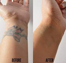 Tattoo camo is a concealer paste that completely covers up your tattoo. How To Cover Up A Tattoo