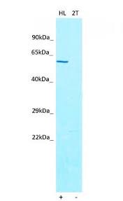 Dylight® is a registered trade mark of thermofisher inc., and its. Zbtb16 Antibody Mybiosource