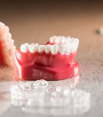 At kozlowski orthodontics our top priority is to provide you with the highest quality. Invisalign Invisalign Teen Owen Orthodontics