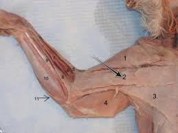 Jun 17, 2021 · the muscles of the thoracic area lie deep to the thoracolumbar fascia, while the muscles of the lumbar area lie between the superficial and middle layers of the fascia. Cat Dissection Muscles Practicum Superficial And Deep Muscles Of Chest Abdomen Shoulder Dorsal Region Thigh Flashcards Quizlet