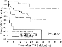 Image result for MELD Score