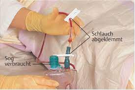 Sie wird nach großen operativen eingriffen verwendet und sorgt dafür, dass blut und wundsekret. Cne Online Certified Nursing Education Bibliothek