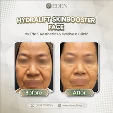 EDEN Aesthetics & Wellness Clinic