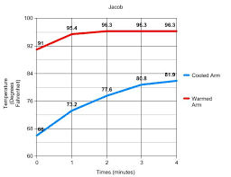 Homeostasis Anatomy Physiology