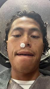 一個禮拜沒下水傷口即將恢復好興奮啊🔥 啊（鼻血又流下來了..