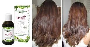 Purtroppo però, per aspettare che i capelli crescano è necessario avere tanta pazienza, a meno che non si decida di. Come Fare Ricrescere I Capelli In Pochi Giorni Con L Olio Di Ricino Rimedio Naturale